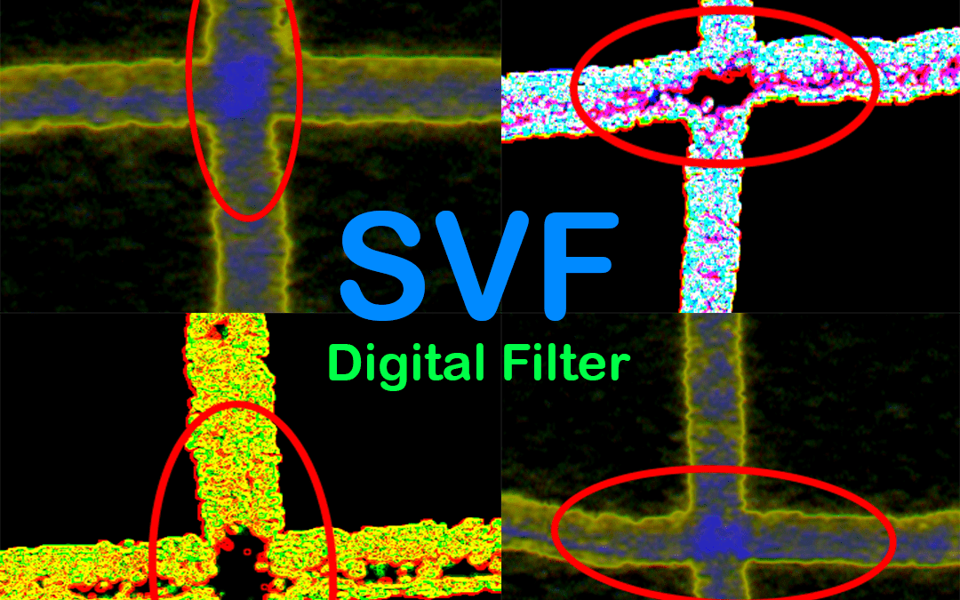 SVF digital filter time sequence at writing crossings